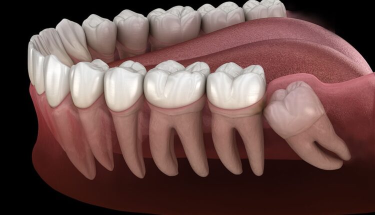 دیگر نگران افتادن دندان نباشید!